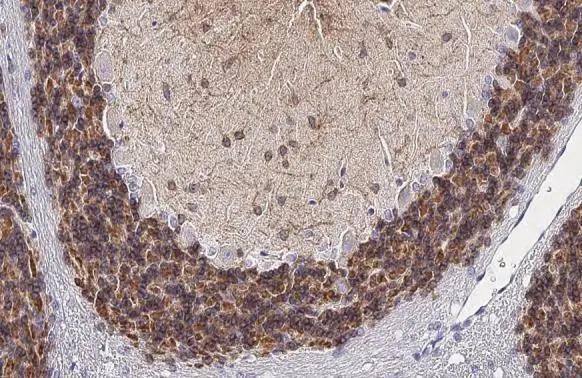 KCC2 Antibody in Immunohistochemistry (Paraffin) (IHC (P))