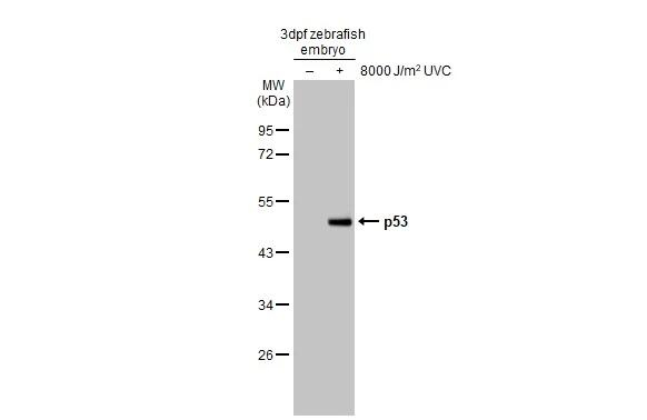 p53 (Tumor Suppressor Protein) Antibody in Western Blot (WB)