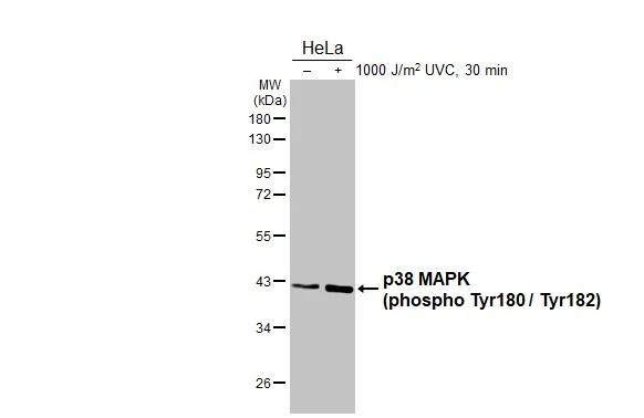 Phospho-p38 MAPK (Thr180, Tyr182) Antibody in Western Blot (WB)