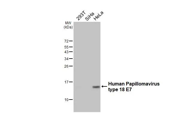 HPV Type 18 E7 Antibody in Western Blot (WB)