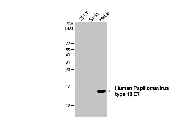 HPV Type 18 E7 Antibody in Western Blot (WB)