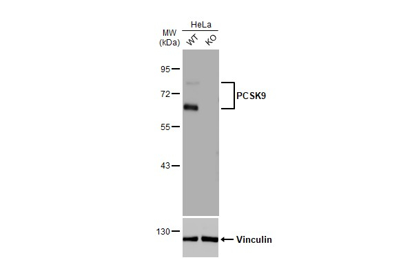 PCSK9 Antibody in Western Blot (WB)