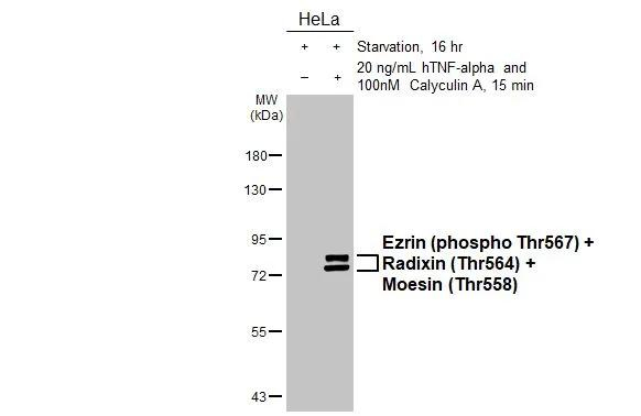 Phospho-Ezrin/Radixin/Moesin (Thr567, Thr564, Thr558) Antibody in Western Blot (WB)