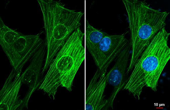 Alpha-Smooth Muscle Actin Antibody in Immunocytochemistry (ICC/IF)