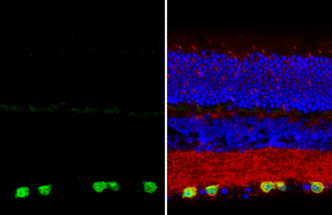 RBPMS Antibody in Immunohistochemistry (Paraffin) (IHC (P))