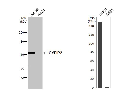 CYFIP2 Antibody in Western Blot (WB)