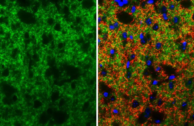 DRD2 Antibody in Immunohistochemistry (Paraffin) (IHC (P))