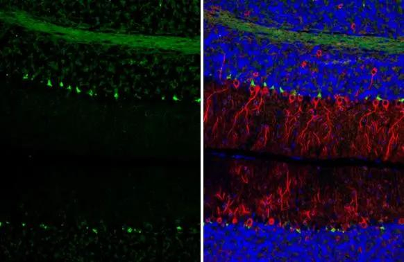 PSD-95 Antibody in Immunohistochemistry (Paraffin) (IHC (P))