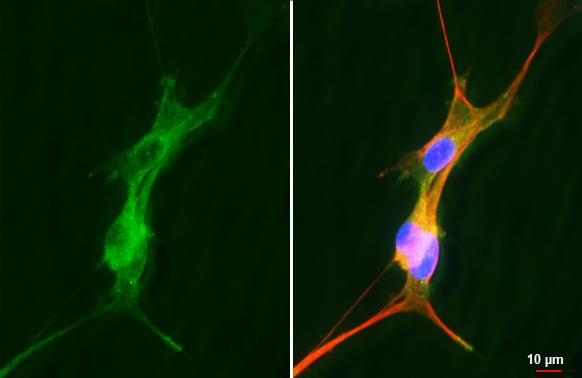 TACR1 Antibody in Immunocytochemistry (ICC/IF)