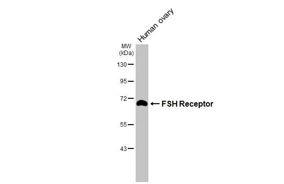 FSHR Antibody in Western Blot (WB)