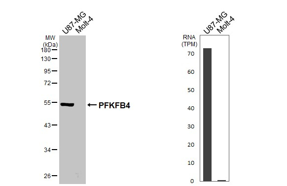 PFKFB4 Antibody in Western Blot (WB)