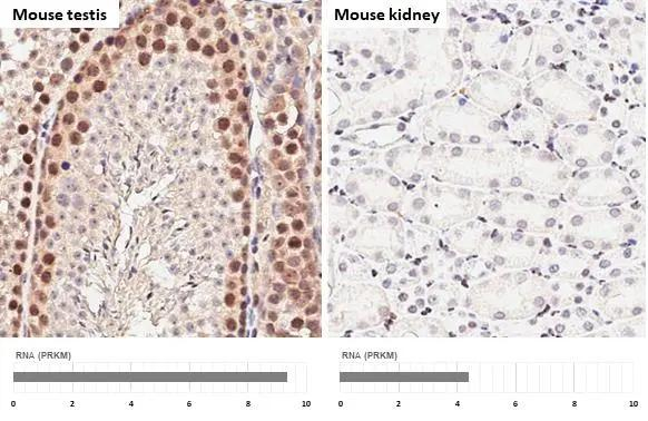 SETDB1 Antibody in Immunohistochemistry (Paraffin) (IHC (P))