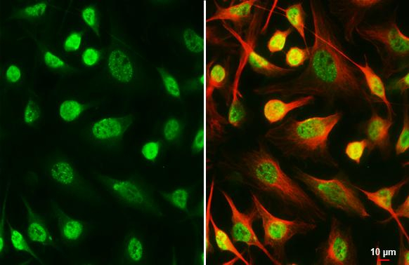SETDB1 Antibody in Immunocytochemistry (ICC/IF)
