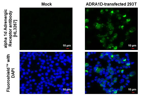 alpha-1d Adrenoceptor Antibody in Immunocytochemistry (ICC/IF)