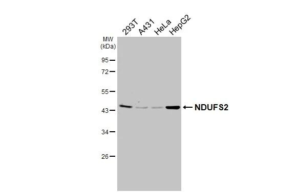 NDUFS2 Antibody in Western Blot (WB)