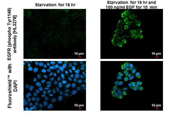 Phospho-EGFR (Tyr1148) Antibody in Immunocytochemistry (ICC/IF)