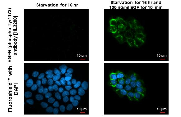Phospho-EGFR (Tyr1173) Antibody in Immunocytochemistry (ICC/IF)