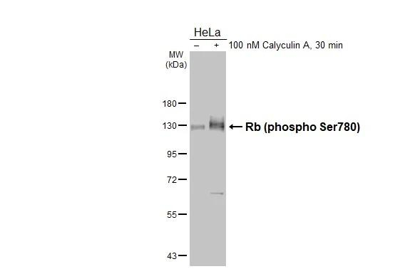 Phospho-Rb (Ser780) Antibody in Western Blot (WB)