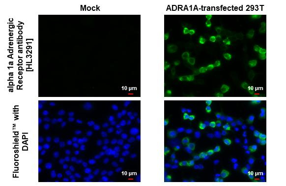 alpha-1a Adrenergic Receptor Antibody in Immunocytochemistry (ICC/IF)