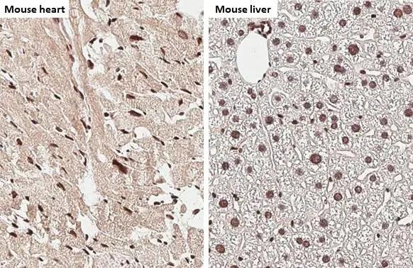 NRF1 Antibody in Immunohistochemistry (Paraffin) (IHC (P))