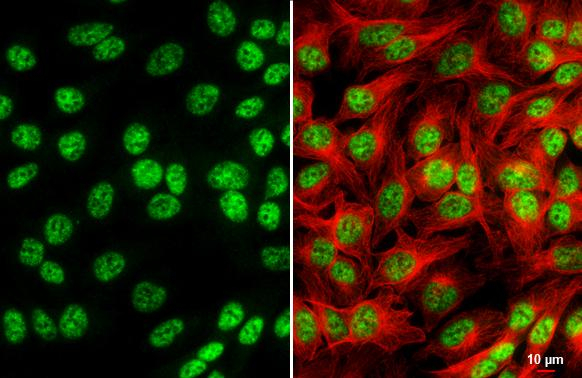 NRF1 Antibody in Immunocytochemistry (ICC/IF)