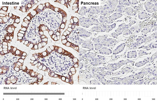 Cytokeratin 20 Antibody in Immunohistochemistry (Paraffin) (IHC (P))