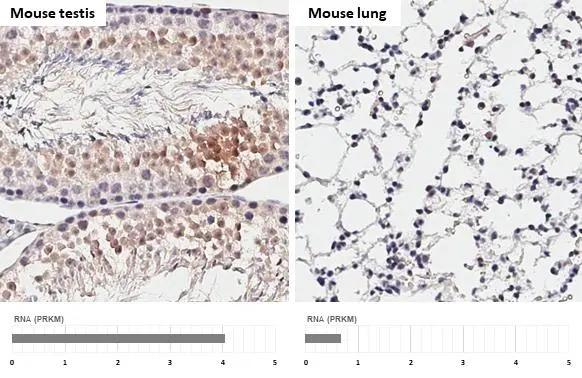 POLI Antibody in Immunohistochemistry (Paraffin) (IHC (P))