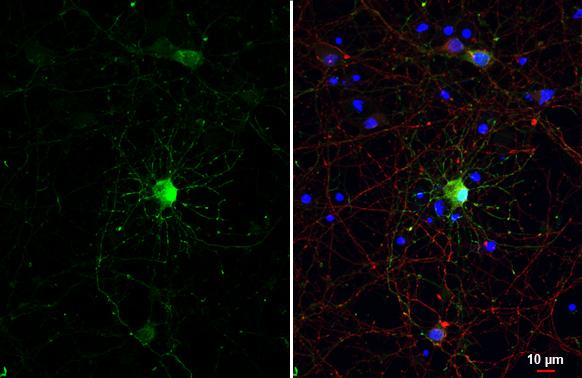 GABA Antibody in Immunocytochemistry (ICC/IF)
