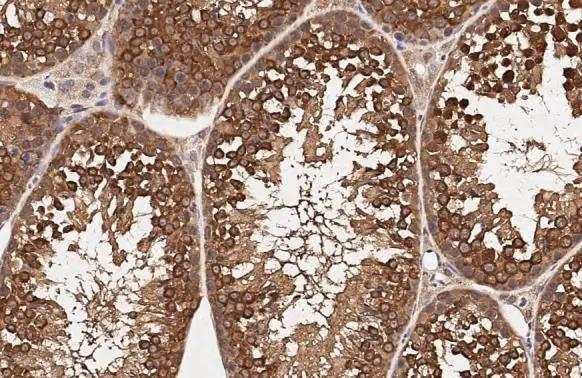RUVBL1 Antibody in Immunohistochemistry (Paraffin) (IHC (P))
