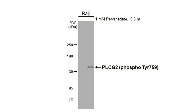 Phospho-PLCG2 (Tyr759) Antibody in Western Blot (WB)