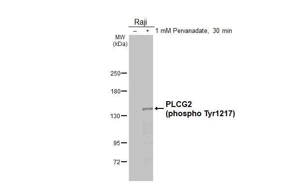 Phospho-PLCG2 (Tyr1217) Antibody in Western Blot (WB)