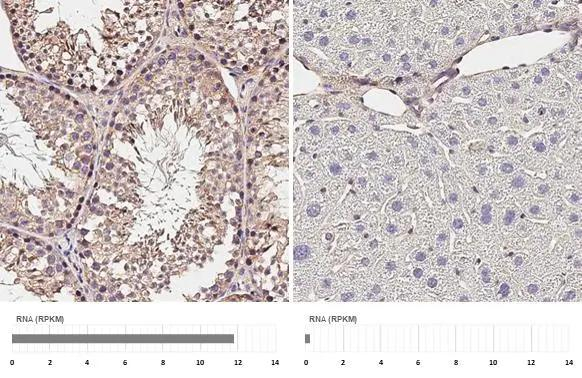 P2X3 Antibody in Immunohistochemistry (Paraffin) (IHC (P))