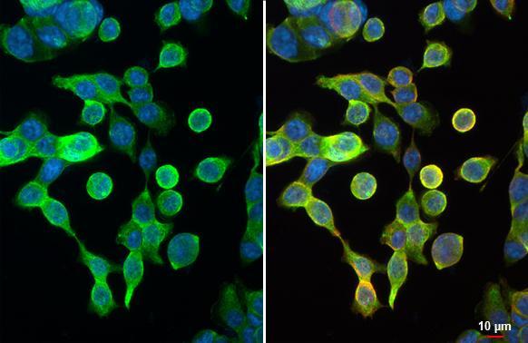 Galectin 4 Antibody in Immunocytochemistry (ICC/IF)