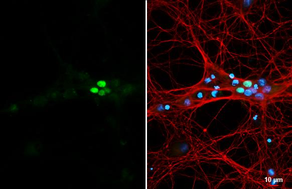 NeuroD1 Antibody in Immunocytochemistry (ICC/IF)