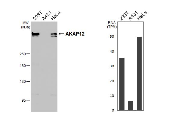 AKAP12 Antibody in Western Blot (WB)