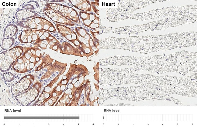 IL1RA Antibody in Immunohistochemistry (Paraffin) (IHC (P))