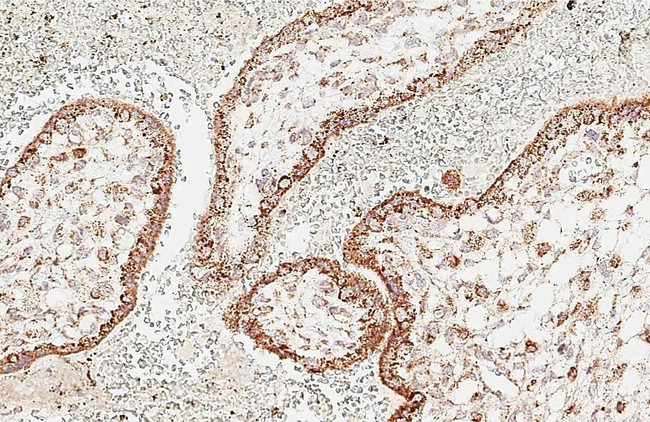 PLK4 Antibody in Immunohistochemistry (Paraffin) (IHC (P))