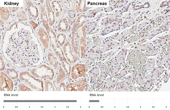SUFU Antibody in Immunohistochemistry (Paraffin) (IHC (P))