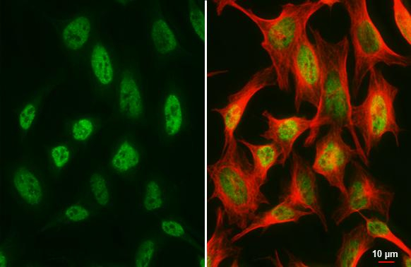 SUFU Antibody in Immunocytochemistry (ICC/IF)