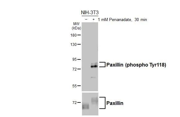 Phospho-Paxillin (Tyr118) Antibody in Western Blot (WB)