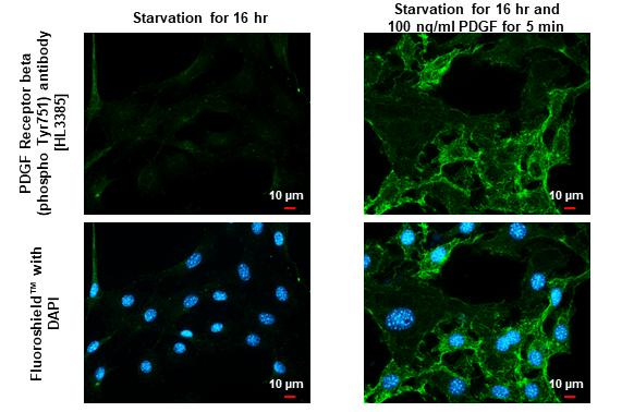 Phospho-PDGFRB (Tyr751) Antibody in Immunocytochemistry (ICC/IF)