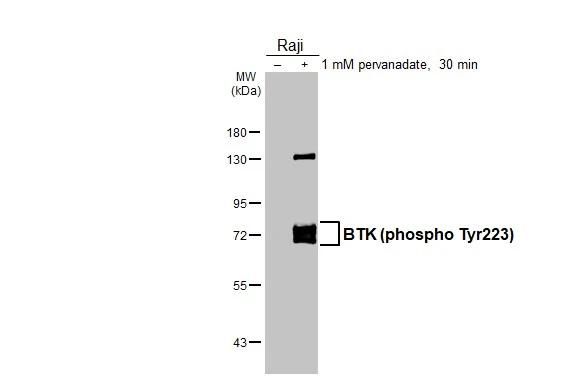 Phospho-BTK (Tyr223) Antibody in Western Blot (WB)