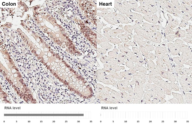 ESRP1 Antibody in Immunohistochemistry (Paraffin) (IHC (P))