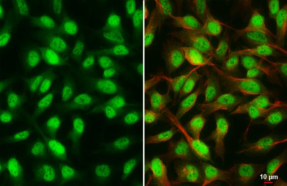 RAD21 Antibody in Immunocytochemistry (ICC/IF)