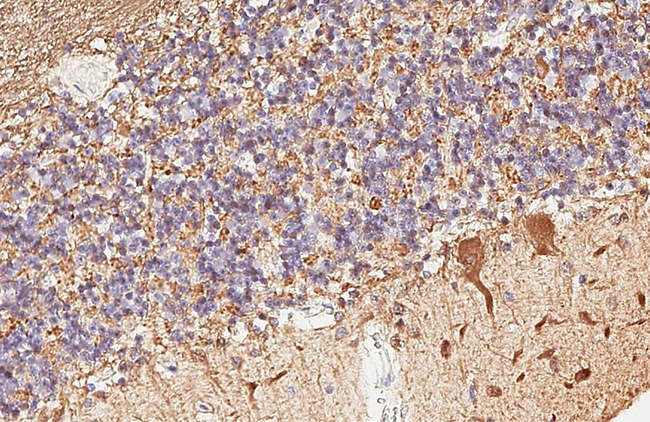 PGP9.5 Antibody in Immunohistochemistry (Paraffin) (IHC (P))