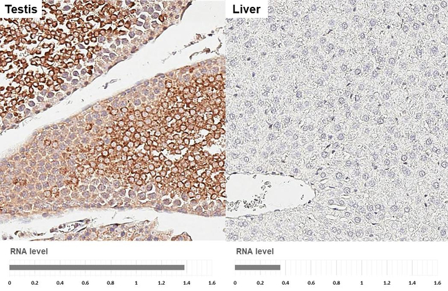 HDAC4 Antibody in Immunohistochemistry (Paraffin) (IHC (P))
