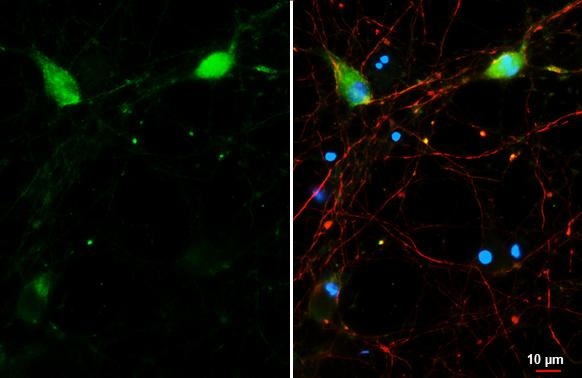mGluR5 Antibody in Immunocytochemistry (ICC/IF)
