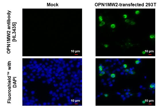 Opsin Red/Green Antibody in Immunocytochemistry (ICC/IF)