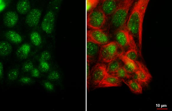 POLR3A Antibody in Immunocytochemistry (ICC/IF)