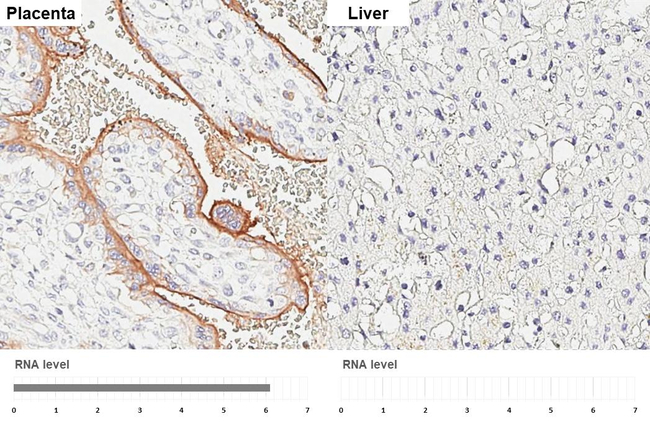 ALPL Antibody in Immunohistochemistry (Paraffin) (IHC (P))
